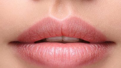 Juvederm Volbella Fillers