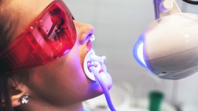 Philips Zoom Teeth Whitening